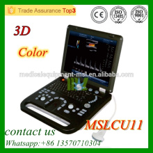 MSLCU11 Appareil d&#39;échographie doppler couleur Système d&#39;échographie Doppler couleur 3D à bas prix